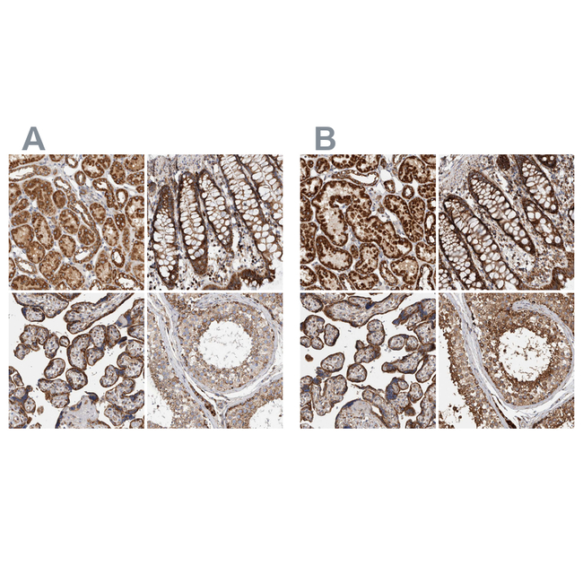 IARS2 Antibody in Immunohistochemistry (Paraffin) (IHC (P))