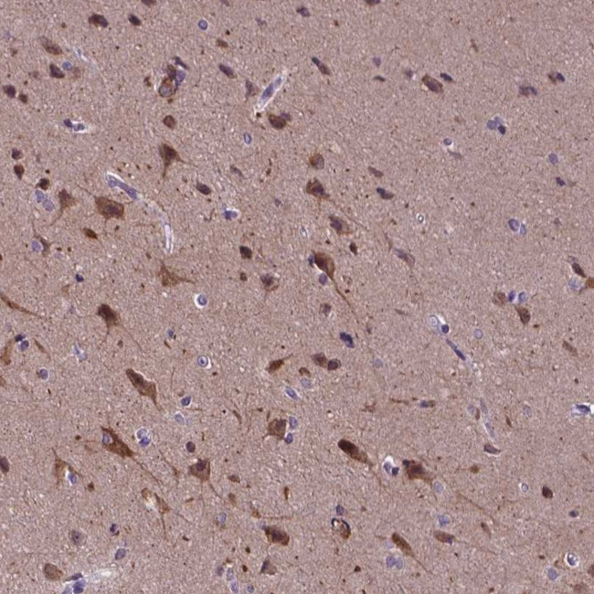 KIAA1107 Antibody in Immunohistochemistry (Paraffin) (IHC (P))
