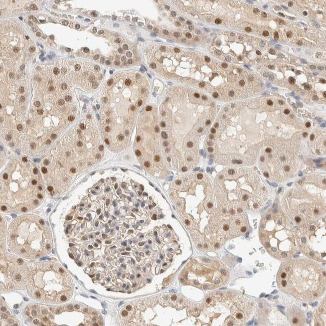 TSTD2 Antibody in Immunohistochemistry (IHC)