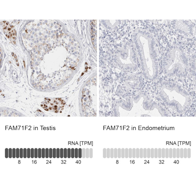 FAM71F2 Antibody in Immunohistochemistry (IHC)