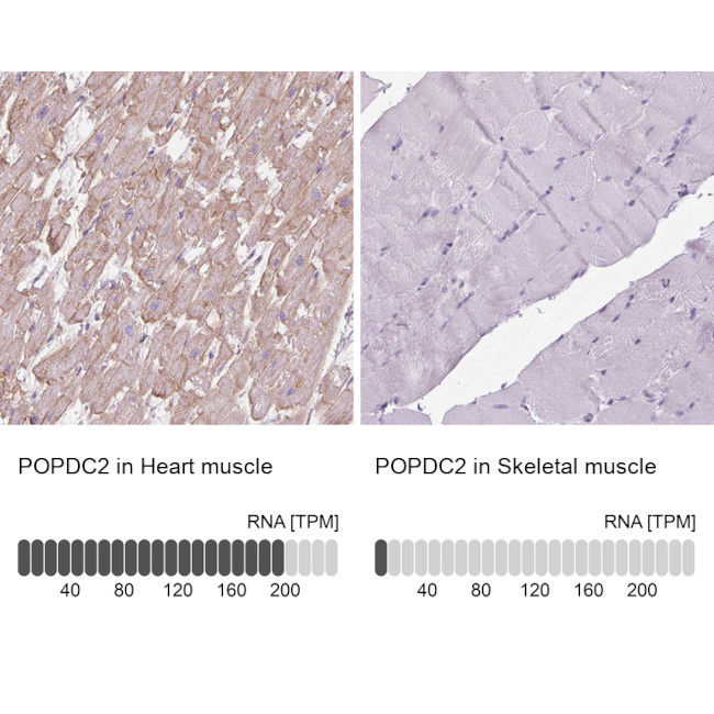 POPDC2 Antibody in Immunohistochemistry (IHC)