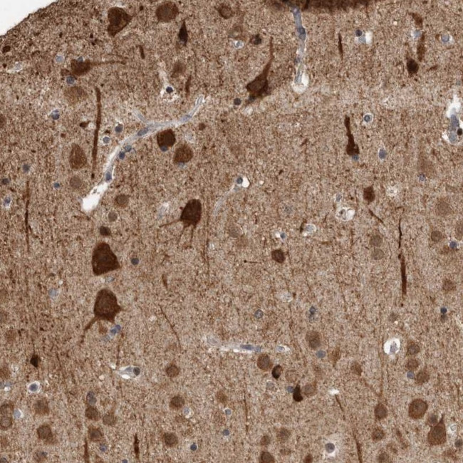 OR2K2 Antibody in Immunohistochemistry (Paraffin) (IHC (P))