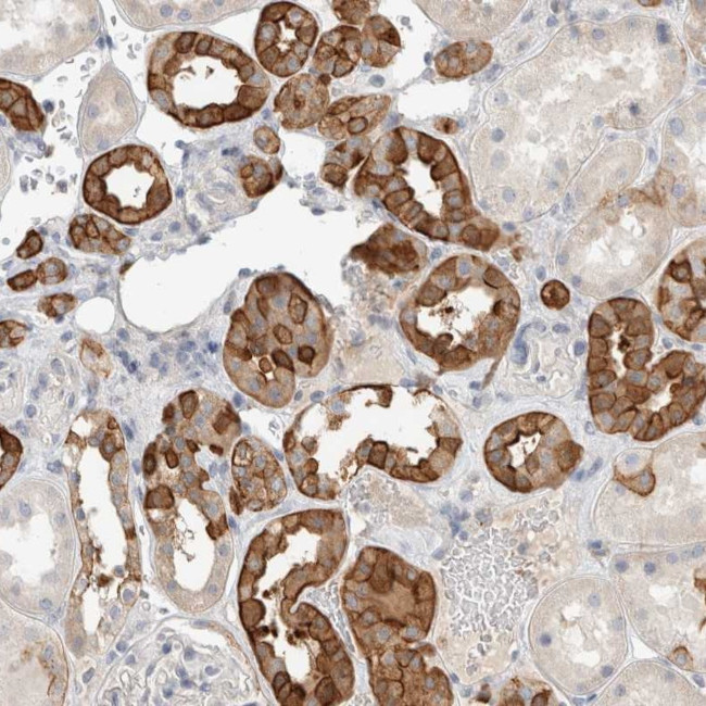 SCIN Antibody in Immunohistochemistry (Paraffin) (IHC (P))