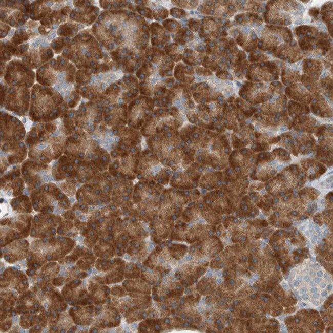 SEL1L Antibody in Immunohistochemistry (Paraffin) (IHC (P))