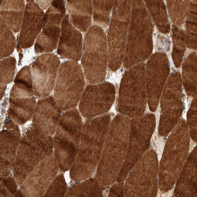 PRDM15 Antibody in Immunohistochemistry (Paraffin) (IHC (P))