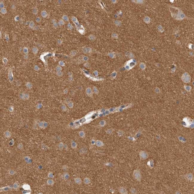 Dematin Antibody in Immunohistochemistry (Paraffin) (IHC (P))
