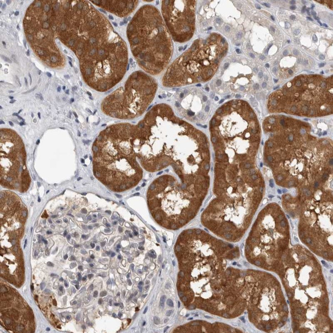 FBXO43 Antibody in Immunohistochemistry (Paraffin) (IHC (P))