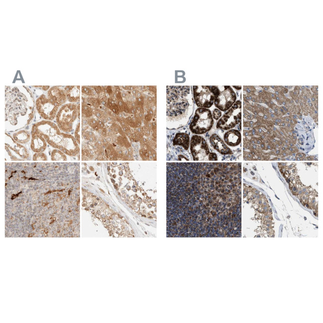 CCDC44 Antibody in Immunohistochemistry (IHC)