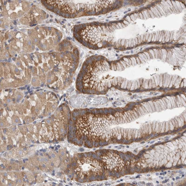 FBXO43 Antibody in Immunohistochemistry (Paraffin) (IHC (P))