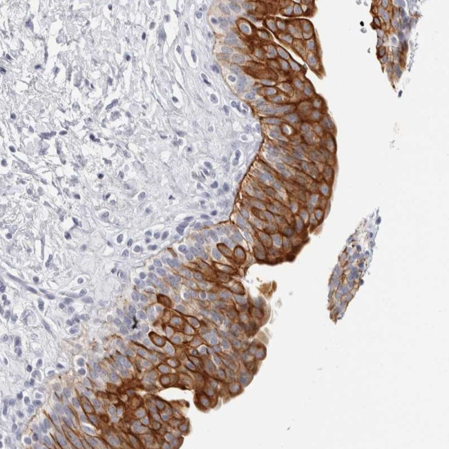 RPH3AL Antibody in Immunohistochemistry (Paraffin) (IHC (P))
