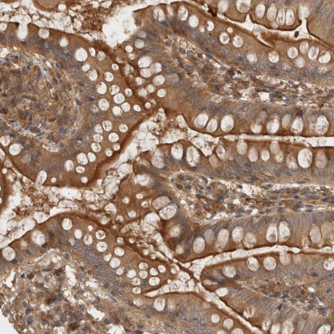 PPP1R42 Antibody in Immunohistochemistry (Paraffin) (IHC (P))