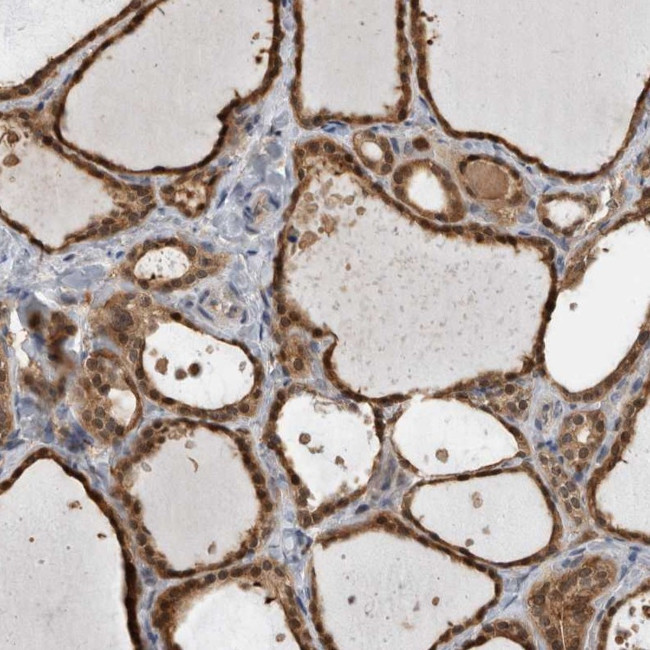 USH1G Antibody in Immunohistochemistry (Paraffin) (IHC (P))