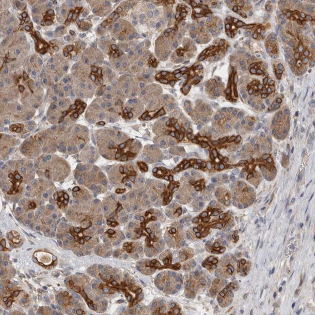 SMAP2 Antibody in Immunohistochemistry (Paraffin) (IHC (P))