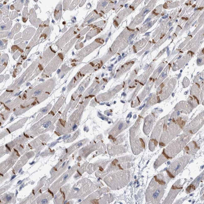 TMEM102 Antibody in Immunohistochemistry (Paraffin) (IHC (P))