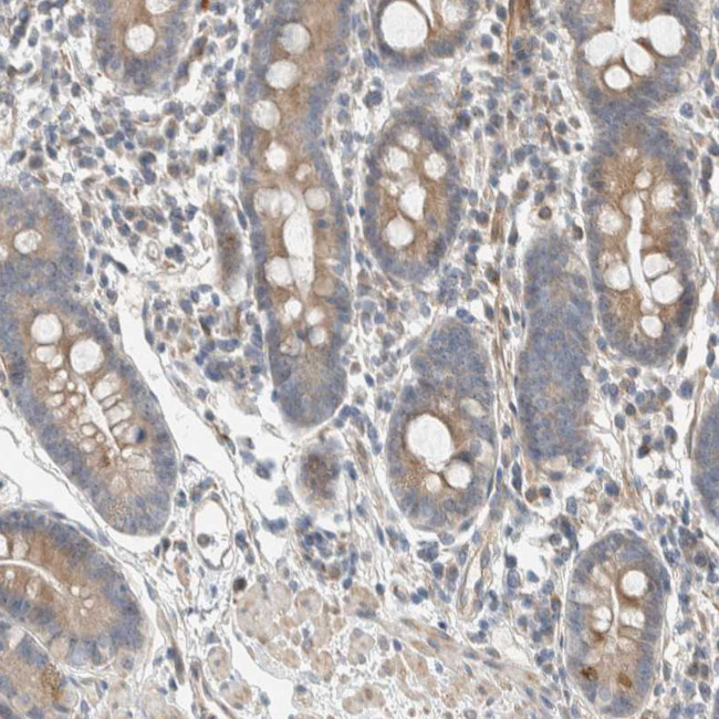SLFN12L Antibody in Immunohistochemistry (Paraffin) (IHC (P))