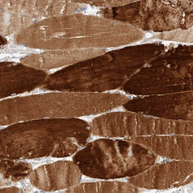 KBTBD5 Antibody in Immunohistochemistry (Paraffin) (IHC (P))