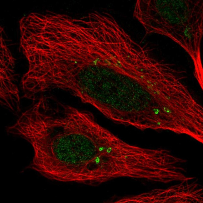 CEP112 Antibody in Immunocytochemistry (ICC/IF)