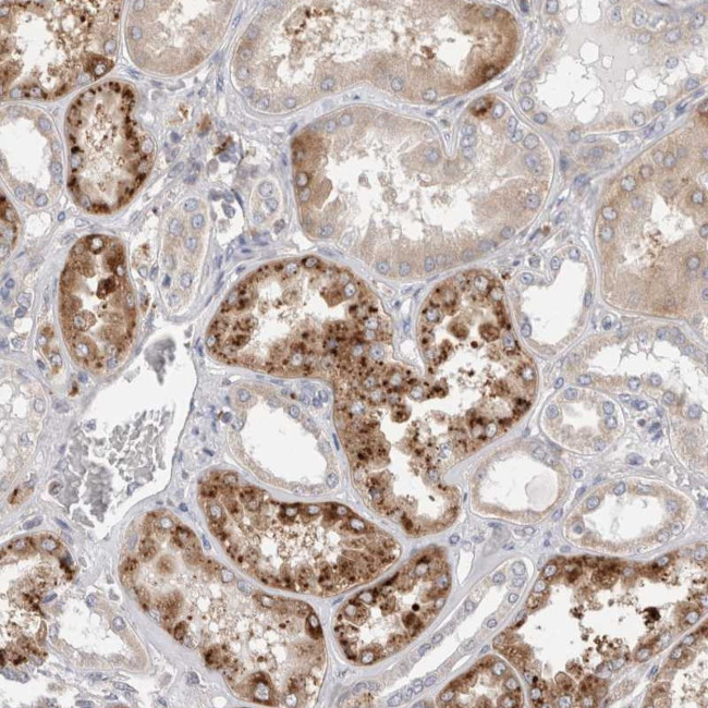 TBC1D16 Antibody in Immunohistochemistry (Paraffin) (IHC (P))