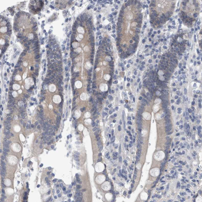 FAM83H Antibody in Immunohistochemistry (Paraffin) (IHC (P))