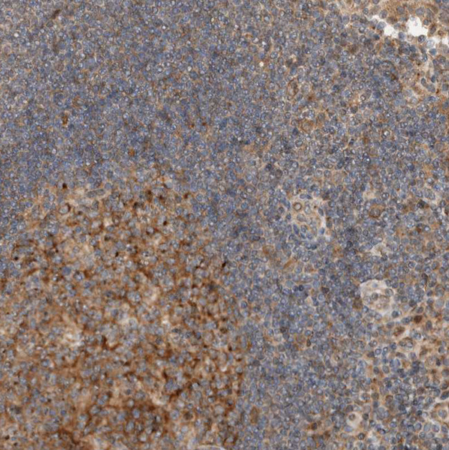 KLHL6 Antibody in Immunohistochemistry (Paraffin) (IHC (P))