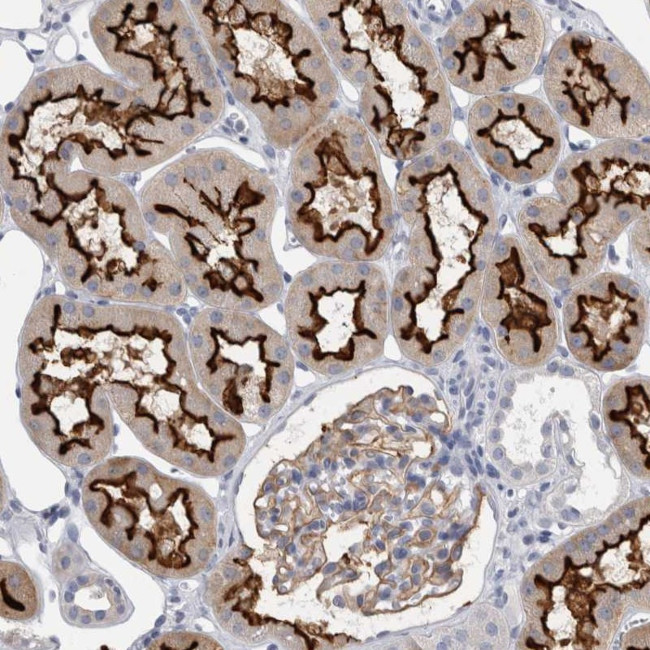 ANKFY1 Antibody in Immunohistochemistry (Paraffin) (IHC (P))