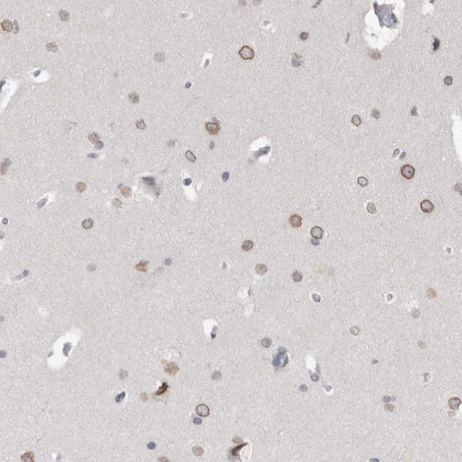 ZNF770 Antibody in Immunohistochemistry (Paraffin) (IHC (P))