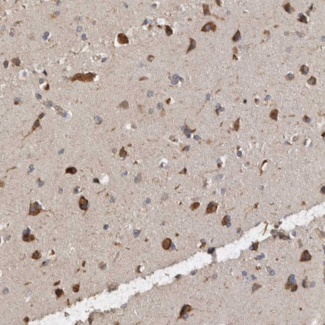 ANKFY1 Antibody in Immunohistochemistry (Paraffin) (IHC (P))