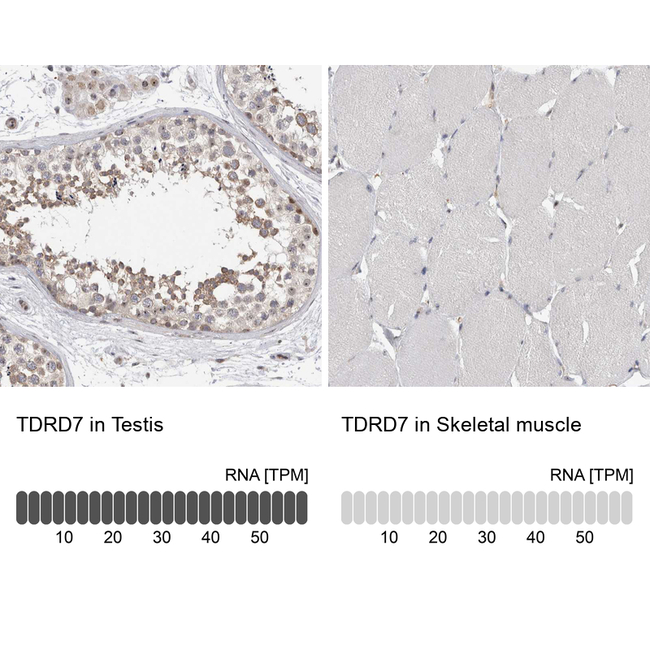 TDRD7 Antibody in Immunohistochemistry (Paraffin) (IHC (P))
