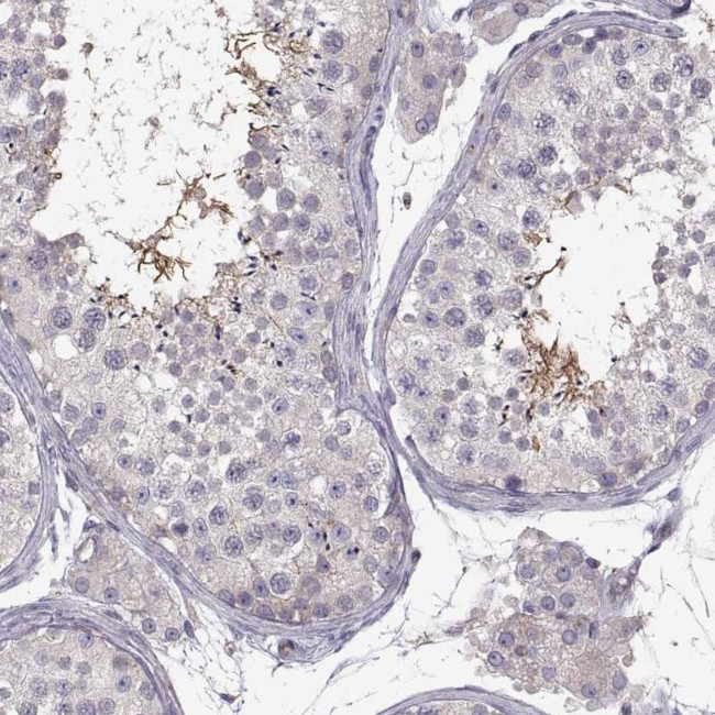SPATA32 Antibody in Immunohistochemistry (IHC)