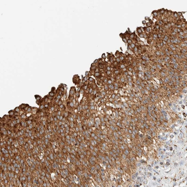 ZNF454 Antibody in Immunohistochemistry (Paraffin) (IHC (P))