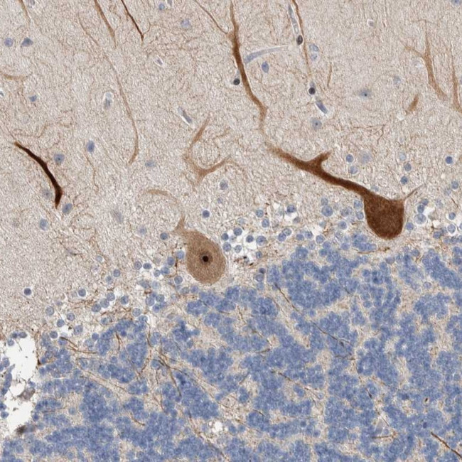 PRRG4 Antibody in Immunohistochemistry (Paraffin) (IHC (P))