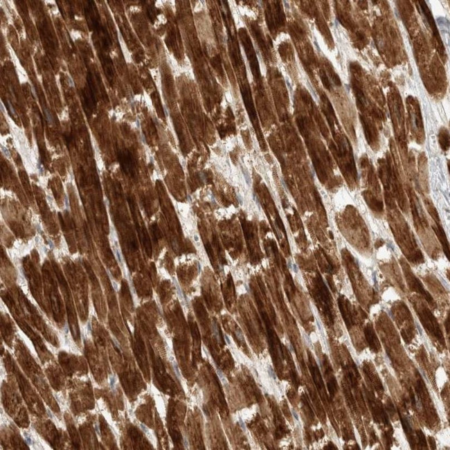 KIF1C Antibody in Immunohistochemistry (IHC)