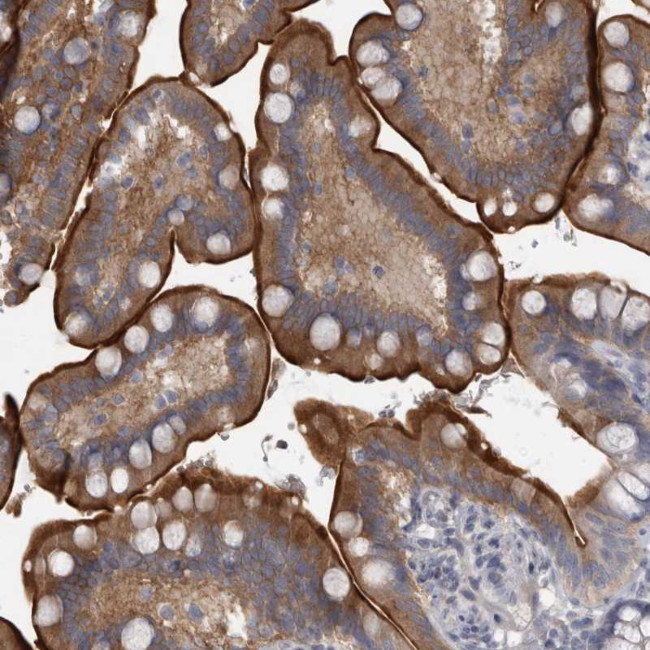 ENPP7 Antibody in Immunohistochemistry (Paraffin) (IHC (P))