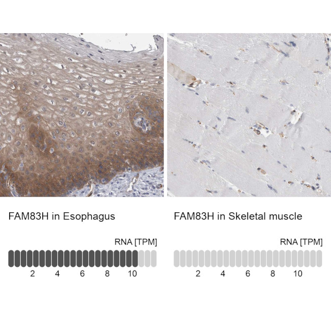 FAM83H Antibody in Immunohistochemistry (IHC)
