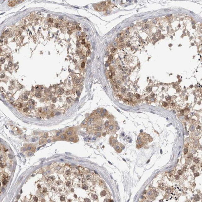 ZNF341 Antibody in Immunohistochemistry (IHC)