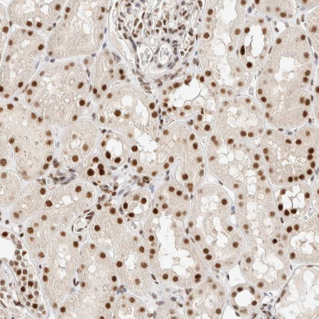 ZNF768 Antibody in Immunohistochemistry (Paraffin) (IHC (P))