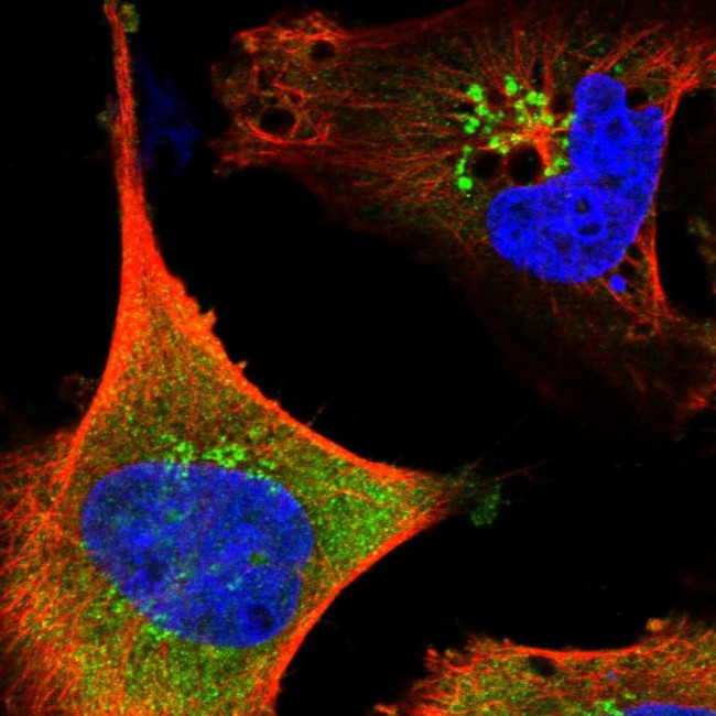 SAMD12 Antibody in Immunocytochemistry (ICC/IF)