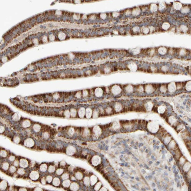 CHADL Antibody in Immunohistochemistry (Paraffin) (IHC (P))