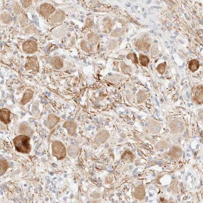 SNTB1 Antibody in Immunohistochemistry (IHC)
