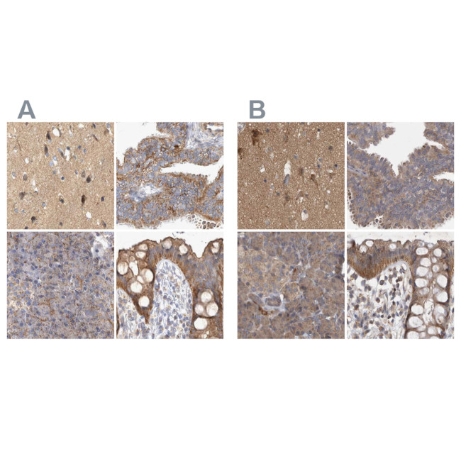 BZRAP1 Antibody in Immunohistochemistry (IHC)