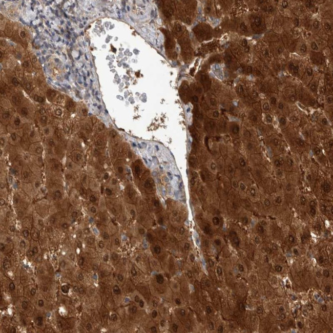RHPN1 Antibody in Immunohistochemistry (Paraffin) (IHC (P))