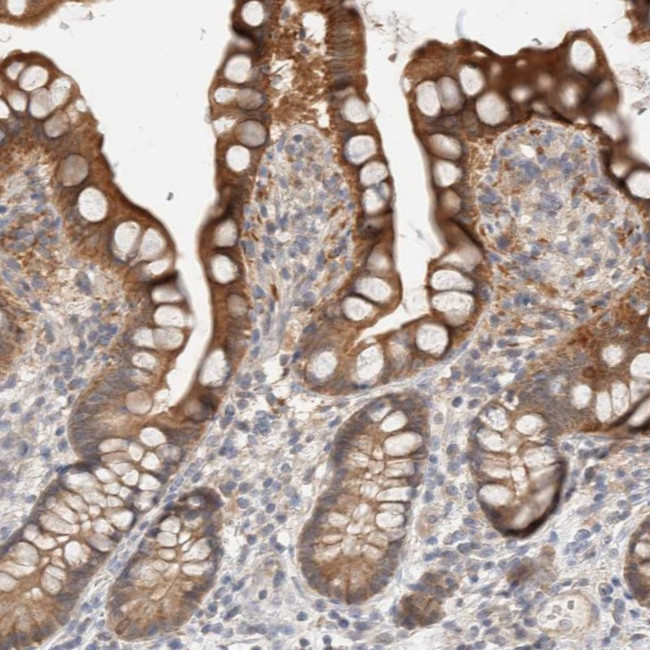 Carbonic Anhydrase XIII Antibody in Immunohistochemistry (Paraffin) (IHC (P))