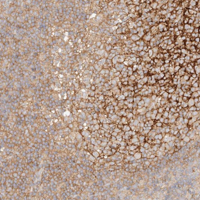 RABEP1 Antibody in Immunohistochemistry (Paraffin) (IHC (P))