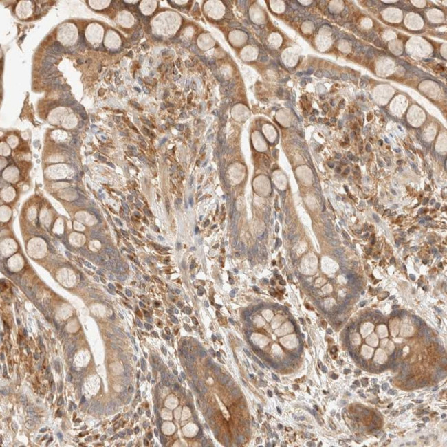 TACC1 Antibody in Immunohistochemistry (Paraffin) (IHC (P))
