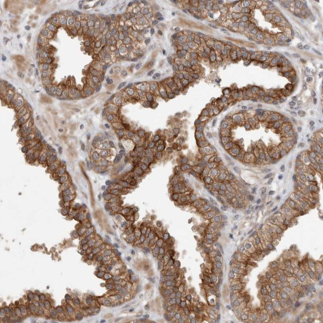 CRISPLD1 Antibody in Immunohistochemistry (Paraffin) (IHC (P))