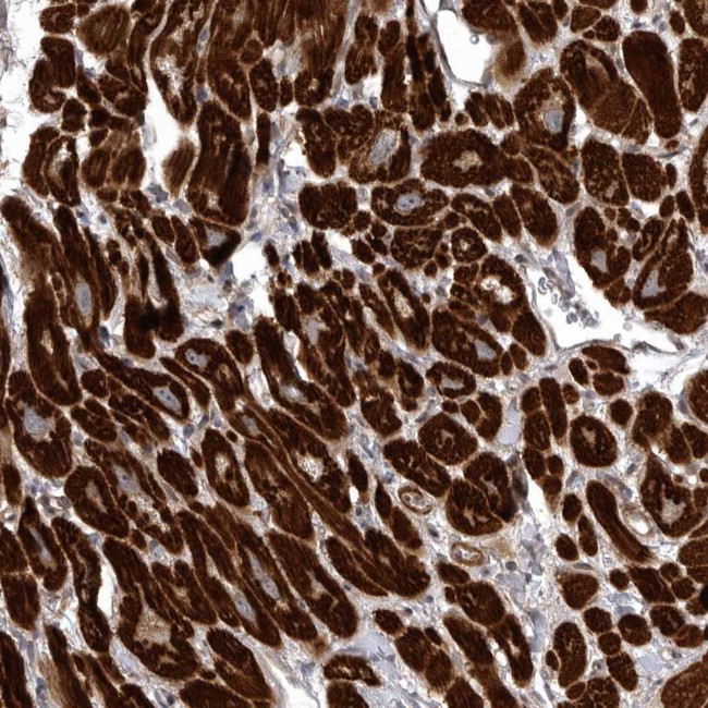 SNX16 Antibody in Immunohistochemistry (Paraffin) (IHC (P))