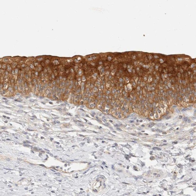 SH3GLB2 Antibody in Immunohistochemistry (IHC)