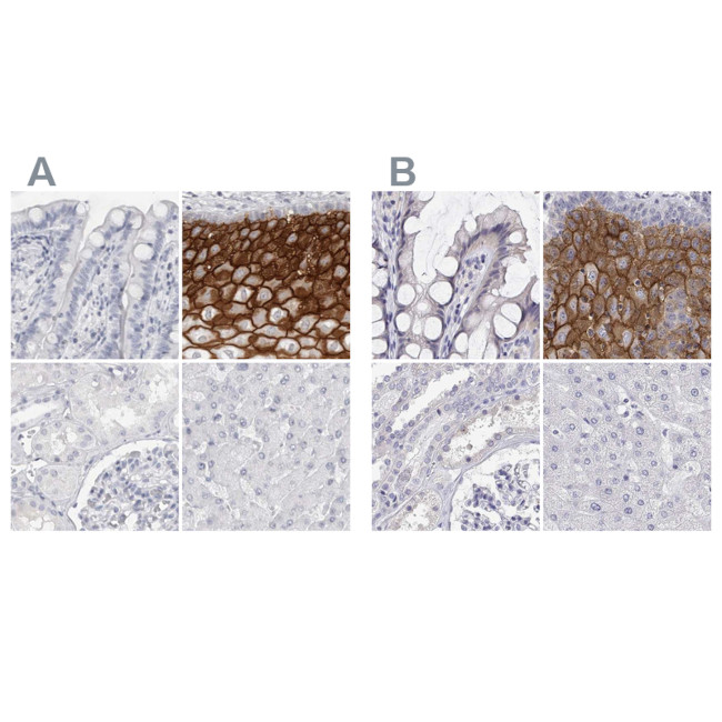 LY6D Antibody in Immunohistochemistry (IHC)