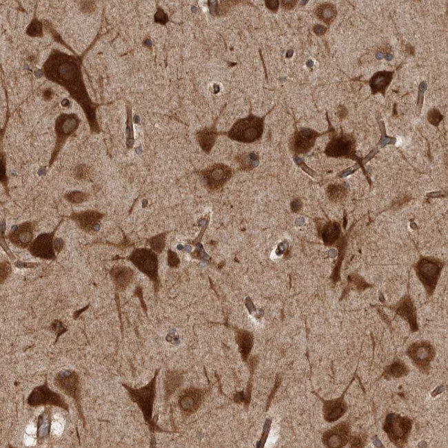 HOOK3 Antibody in Immunohistochemistry (Paraffin) (IHC (P))