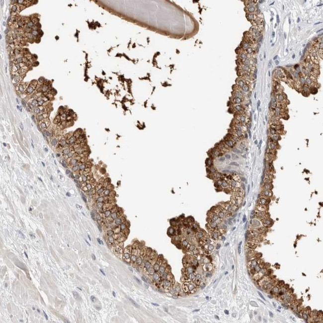 ZNF502 Antibody in Immunohistochemistry (Paraffin) (IHC (P))